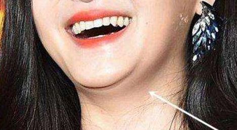 恩施州中心醫(yī)院整形外科療效如何？專家解析+服務費用披露