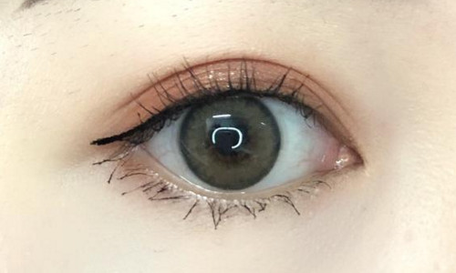 杭州新生植發(fā)醫(yī)院唯一合法正規(guī)嗎？坐診醫(yī)生如何介紹？