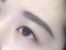 李炳澮醫(yī)生獨特的技術(shù) 手術(shù)風(fēng)格有何特點？并附帶隆鼻案例分析