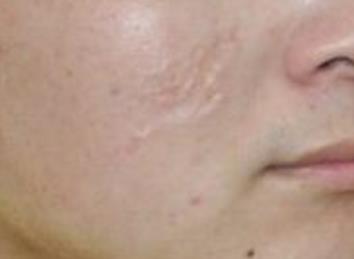 上海雙孖醫(yī)療美容門診部的醫(yī)生技術(shù)和口碑如何？為什么選擇他們？