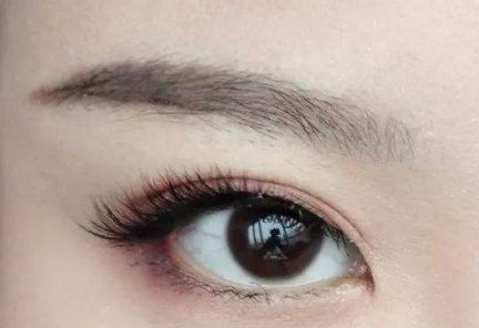 大連王琳雙眼皮的完美實踐，80天親身體驗揭秘