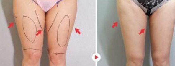 國內(nèi)頂級隆胸醫(yī)生名人榜，權(quán)威大咖云集