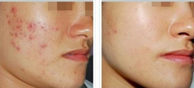 精準又放心！臉部開眼角手術推薦哪座醫(yī)院好？