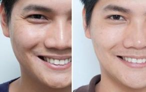 深圳整形醫(yī)院盛名鼎革，不容錯過！