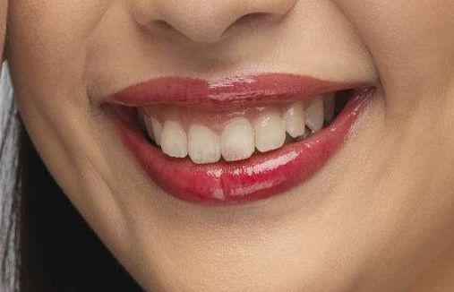 2023年北京近視手術(shù)高手引領(lǐng)潮流，瞿長斌、林順潮、熊瑛等五位專家資料公開！