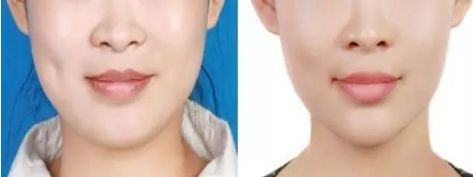 武漢市優(yōu)質近視手術醫(yī)院排名榜單精選！信賴度極高的醫(yī)療機構！