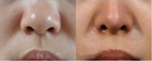 上海哪家醫(yī)院進(jìn)行拉皮手術(shù)的技術(shù)和聲譽(yù)最出色？