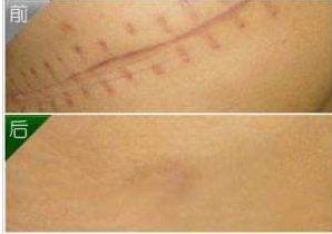 杭州面部脂肪填充推薦，首選頂級醫(yī)生信息大揭密