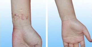 昆明最適合割雙眼皮的醫(yī)院是哪家？重點推薦的幾家醫(yī)院有哪些？