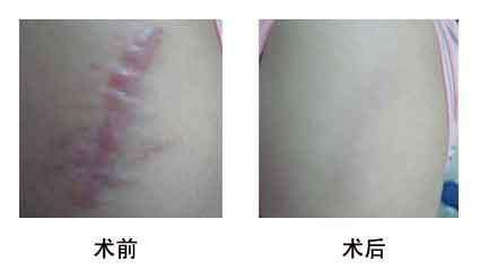 濟(jì)南有哪些人氣更高的美容整形醫(yī)院海峽和旭美如何評(píng)價(jià)