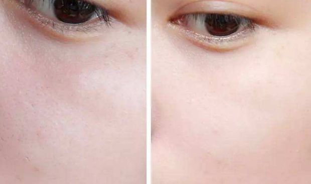 南京懿佳劉育鳳教您輕松擁有雙眼皮！專家妙手將為您呈現(xiàn)無數(shù)成功案例！