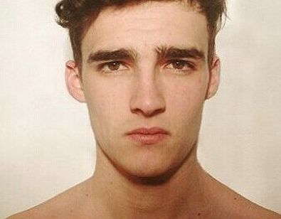 湘雅醫(yī)院龍劍虹的口碑如何？醫(yī)術(shù)出眾，附真實(shí)雙眼皮術(shù)后恢復(fù)圖！