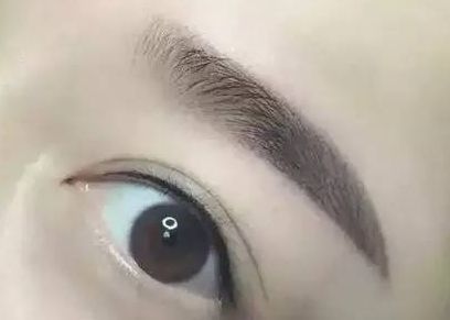 醫(yī)生楊明勇：從技術(shù)實(shí)力到用戶評價(jià)揭秘，提眉案例評價(jià)出乎預(yù)料！