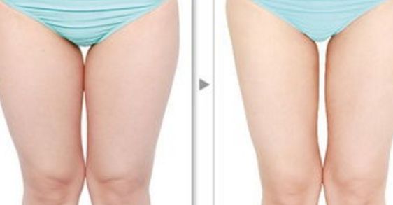 成都吳江山隆胸專家分享醫(yī)生實(shí)力和患者經(jīng)歷