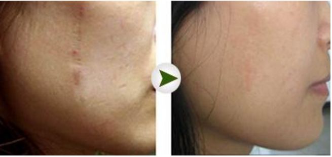 成都眼部修復(fù)排名前三的醫(yī)生——?jiǎng)⑤o容、李競(jìng)、盧尚兵等