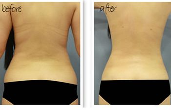 北京哪位醫(yī)生在八大處進行隆胸手術(shù)較為專業(yè)？