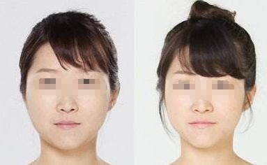 廣州哪家醫(yī)院能夠有效除皺？詳細(xì)介紹醫(yī)院基本情況分享