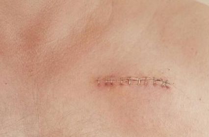 溫州附屬第一醫(yī)院鄭君達(dá)主治領(lǐng)域及醫(yī)療項目詳解