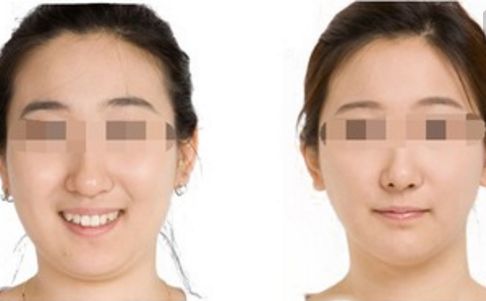 鄭州哪位醫(yī)生在鼻整形領(lǐng)域赫赫有名？口碑出類拔萃的五位專家揭曉！