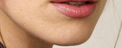 2023年北京大腿脂肪醫(yī)院排名對比，醫(yī)療技術(shù)強勁競爭