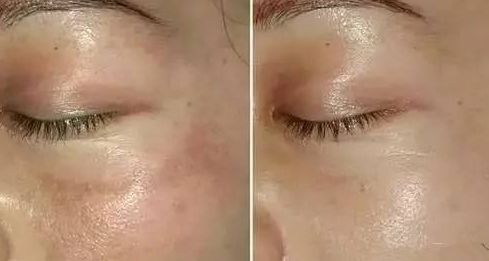 常州市第一人民醫(yī)院整形燒傷科：找對醫(yī)生，就對了！