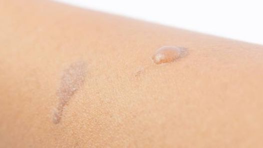 探尋武漢伽美醫(yī)療美容醫(yī)院的醫(yī)術(shù)精湛，備受矚目的醫(yī)生坐診名單公布