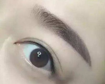 廈門哪家整形醫(yī)院口碑好？專家推薦薇格、中山前三！