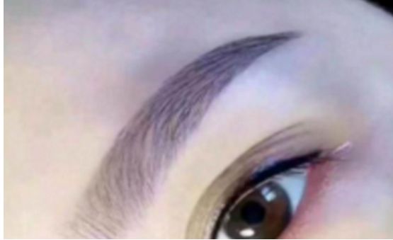 上海求美醫(yī)院最權(quán)威的拉皮整形專家名單及案例分享，查看收費(fèi)明細(xì)表