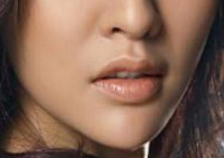 滄州中心醫(yī)院整形科馬超雙眼皮修復(fù)有哪些效果？是否可持久保持雙眼皮效果？