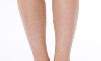 北京聯(lián)合麗格王巖醫(yī)生雙眼皮療效大揭秘，令人驚艷的成功案例浮出水面