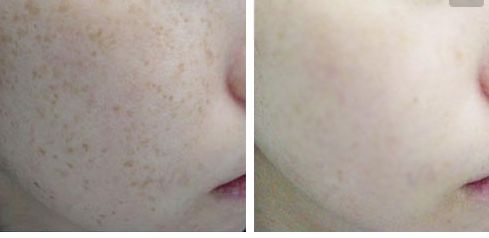 2023南寧臉部整形領(lǐng)域中醫(yī)生技術(shù)評(píng)析