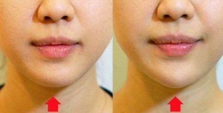 安徽乳房修復(fù)整形醫(yī)院哪家靠譜？公立三甲推薦！專(zhuān)家團(tuán)隊(duì)值得信賴(lài)