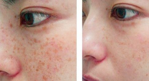 贛州亞韓醫(yī)療美容門診部整形手術(shù)適合嗎？吳禮誠醫(yī)生技術(shù)評價(jià)如何