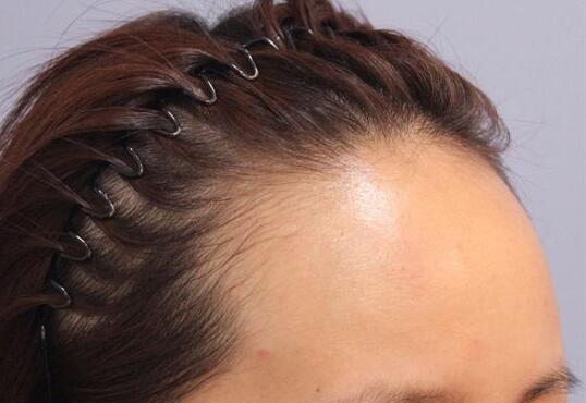 哈爾濱羽禪醫(yī)美，哪些熱門項目受歡迎？