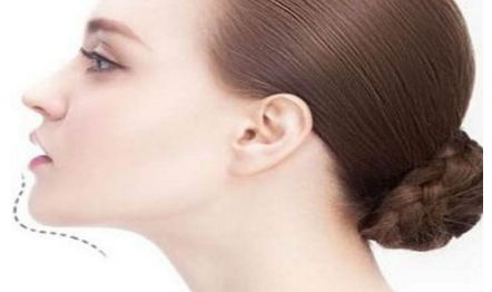 江門植發(fā)醫(yī)院專業(yè)推薦！華美植發(fā)、瑪恩植發(fā)被廣大客戶一致好評！