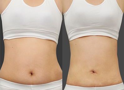 智慧選擇，打造肌膚零瑕疵！廣東祛斑醫(yī)院大比拼，真實實力PK！