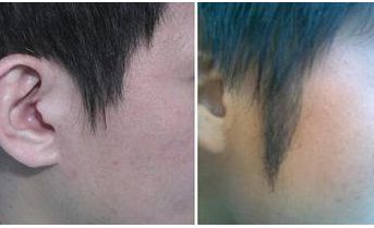 西安著名拉皮手術(shù)醫(yī)生推薦！專家團隊不俗技藝，魯禮新、楊萬忠亮相