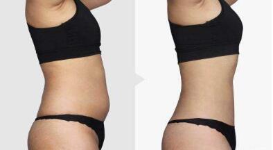 沈陽國防醫(yī)院簡介：為什么選擇沈陽國防醫(yī)院進行醫(yī)美整形？