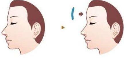 高州人民醫(yī)院美容整形科的專家真的靠譜嗎？高州人民醫(yī)院美容整形科的專家權(quán)威嗎？