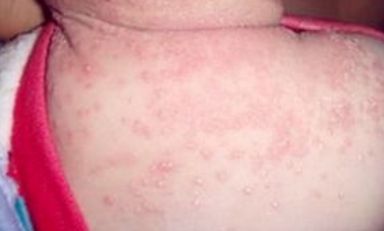 蘇州維多利亞美容醫(yī)院：醫(yī)生團(tuán)隊(duì)實(shí)力如何？案例果效反饋醫(yī)生信息匯總