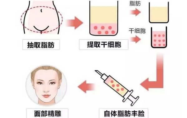 從醫(yī)生個人資料到豐胸案例圖對比，揭秘王沛森的豐胸效果！