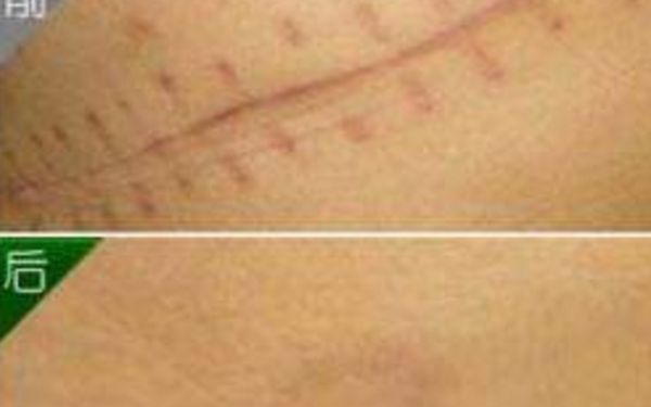 北京非常受歡迎的鼻部整形醫(yī)生，排名一覽！