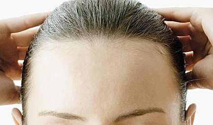 郭建玲雙眼皮修復(fù)費(fèi)用揭秘！看真實(shí)案例圖分享，了解其技術(shù)效果！