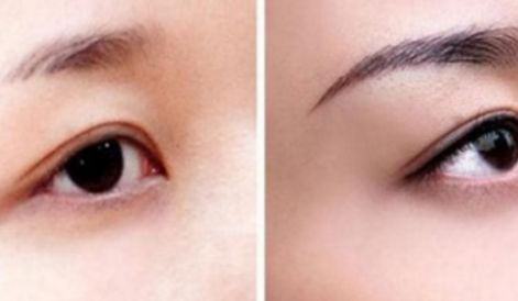 新一期海南隆鼻醫(yī)院名單來啦！維多利亞實(shí)力引領(lǐng)口碑榜！