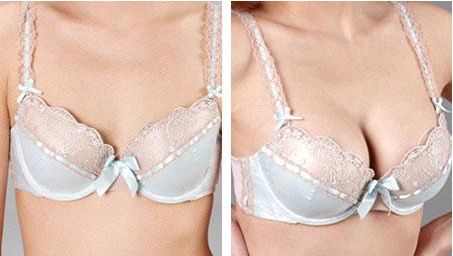 北京腿型矯正的優(yōu)秀醫(yī)院排行榜，2023年度口碑醫(yī)院推薦