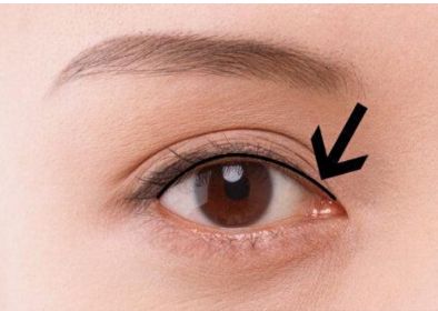 南京胸部整形醫(yī)生吳國平的最新成功案例！