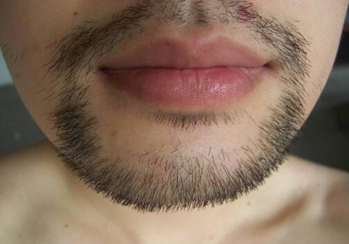 哪些醫(yī)院是滄州祛疤的好選擇？你知道嗎？