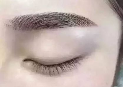 寧波美容整形醫(yī)院有哪些值得關(guān)注？這幾家醫(yī)院的口碑如何？