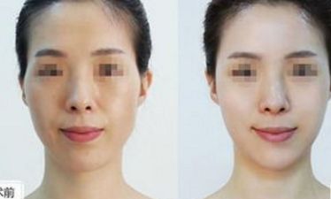 郴州市十佳整形醫(yī)院盤點(diǎn)，名醫(yī)推薦，千萬不要錯過！