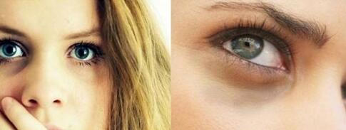 廈門碧蓮盛植發(fā)醫(yī)院效果如何？安全可靠嗎？